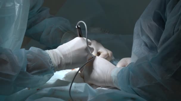 Detailní Záběr Rukou Chirurgického Týmu Během Operace Chirurgickými Laparoskopickými Nástroji — Stock video