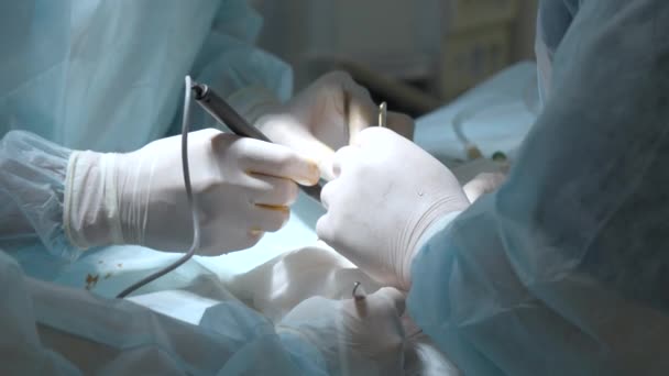 Cirurgiões Qualificados Luvas Brancas Realizando Manipulações Com Corpo Paciente Sob — Vídeo de Stock