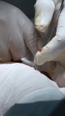 Ameliyat kapanıyor. Başla. Cerrah elleri ameliyat aletleriyle ameliyat yapıyor.