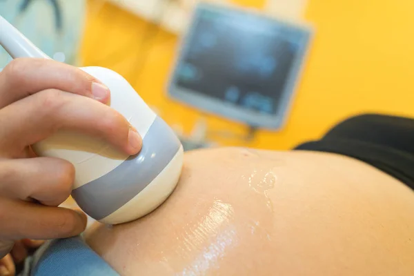 Nőgyógyász Ellenőrzi Női Betegek Magzati Életjeleit Ultrahang Szkennerrel — Stock Fotó