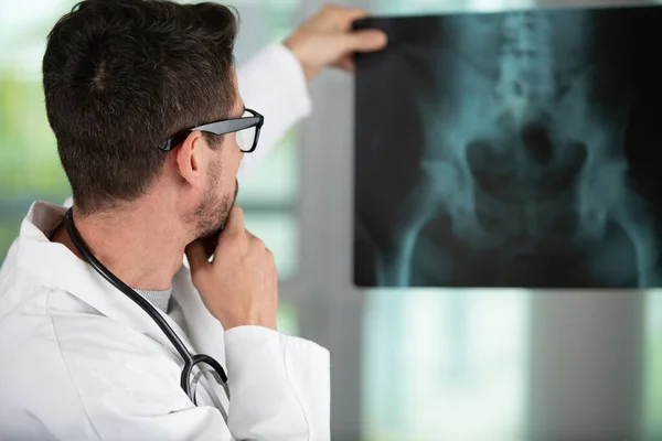 Radiologe Mann Überprüft Ein Röntgenbild — Stockfoto