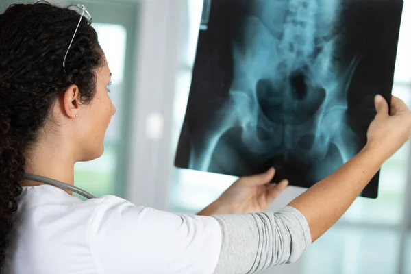 Krankenschwester Betrachtet Röntgenergebnisse Stockbild