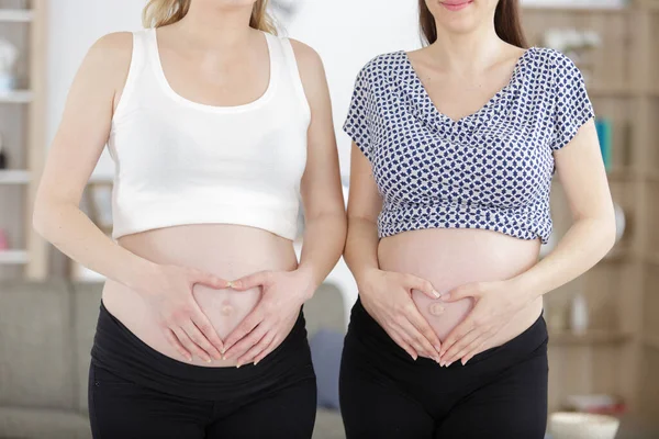 Mujeres Embarazadas Jóvenes Acarician Vientre — Foto de Stock