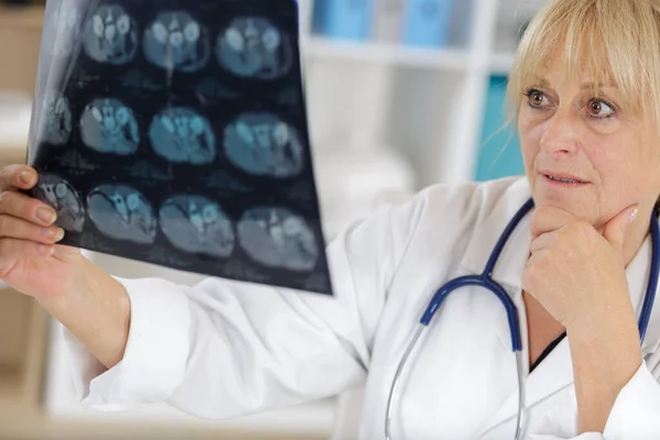 Olgun Kadın Doktor Röntgen Görüntüsüne Bakıyor — Stok fotoğraf
