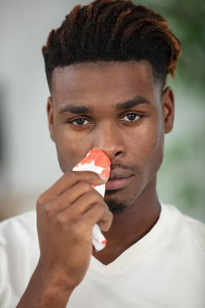 Young Man Touching His Bleeding Nose — Stock Photo, Image