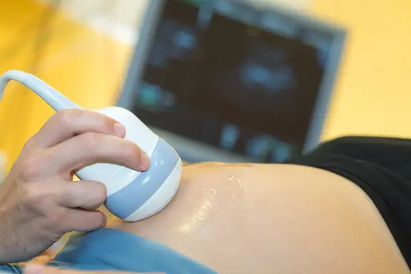 病院の妊婦に超音波スキャンを説明する医師 — ストック写真