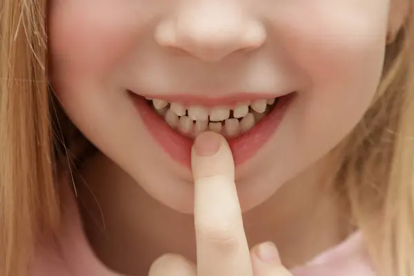 かわいいプリスクールの少女は緩いプライマリ 赤ちゃん の歯を示しています ロイヤリティフリーのストック写真