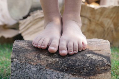 Ağaç gövdesinde çocuk ayakları, ağaç gövdesinde yalın ayak küçük kız, kırsal yaşam tarzı, topraklama ve doğayla bağlantı kavramı.