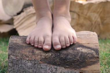 Ağaç gövdesinde çocuk ayakları, ağaç gövdesinde yalın ayak küçük kız, kırsal yaşam tarzı, topraklama ve doğayla bağlantı kavramı.