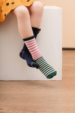 Çocuk farklı bir çift çorap giyiyor. Uyumsuz çoraplar, stüdyo fotoğrafçılığı. Down sendromu farkındalık konsepti, garip çoraplar günü, zorbalık karşıtı hafta.