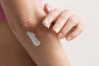 Dirsek kremi süren bir kadın. Güzellik ve vücut bakımı. Dirsek bölgesinde kışın kaşındıran kuru deri..