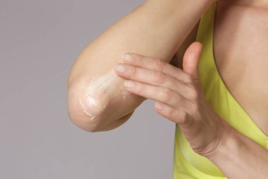 Dirsek kremi süren bir kadın. Güzellik ve vücut bakımı. Dirsek bölgesinde kışın kaşındıran kuru deri.