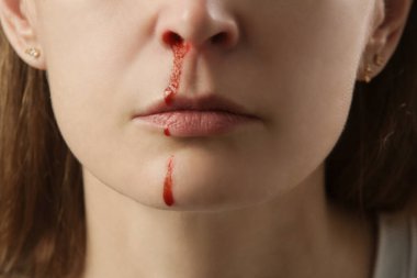 Burnu kanayan, burnu kanayan genç bir kadın. Sağlık ve tıbbi konsept. Stüdyo resmini kapat.