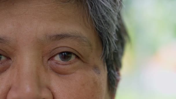 Close Senile Cataract Eye Examination White Cloudy Disc Seen Black — Stockvideo