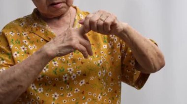 Yaşlı Asyalı kadın hastalar romatizma eklem iltihabından dolayı ellerindeki uyuşma ağrısından muzdarip. Son sınıf öğrencisi kadın bileği ağrıdığı için eline masaj yapıyor. Eklem ağrısı, romatizma eklem iltihabı ve el sorunları..