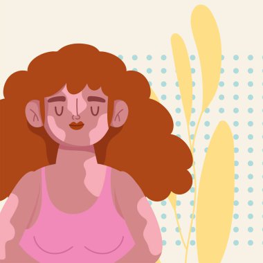 perfectly imperfect, woman with vitiligo cartoon