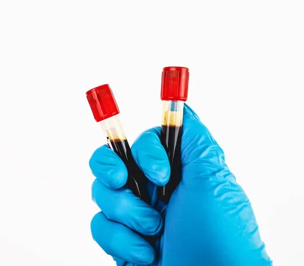 A blood test sample tube with a red cap is in the hand of a blue gloved doctor, object isolated on white background, hematology healthcare laboratory concept