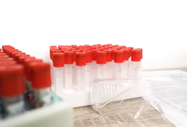 A empty blood test sample tube with a red cap on desk in the hematology lab,  hematology healthcare laboratory concept