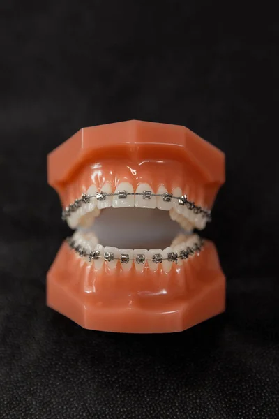 用橡胶坝力 夹钳和牙孔冲出人类的下颚 高速牙科手镯的头部 黑色背景上有保险杠和金属镜 牙科医生 — 图库照片