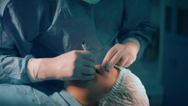 Närbild Manlig Kirurg Med Glasögon Som Skär Form Patientens Ögonlock — Stockvideo