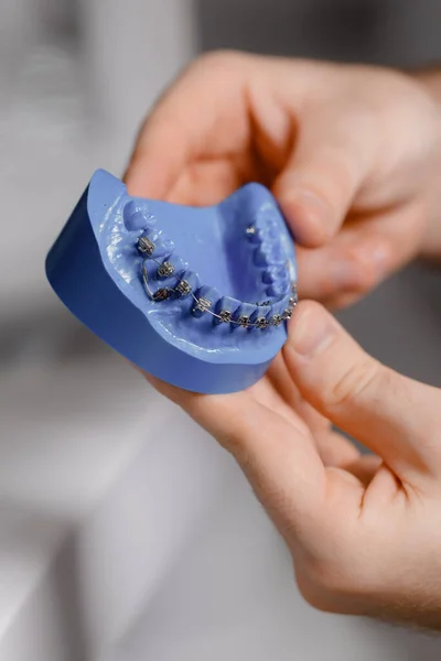 牙医会展示如何用牙刷在下巴上刷牙 医生们在工作时戴着手套 牙齿模型用于演示 牙科医生 — 图库照片