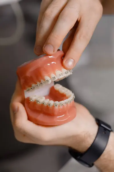 陶瓷牙面饰物 对下排假牙在假牙上排列的近距离观察 医学概念 浅色的Dof 牙科医生 — 图库照片