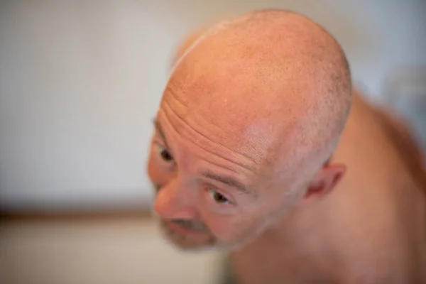 stock image psycho man shaved head and beard in clinic