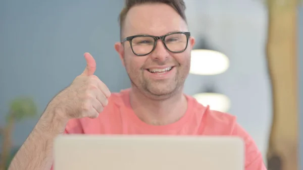Close Thumbs Young Adult Man Working Laptop — Stockfoto