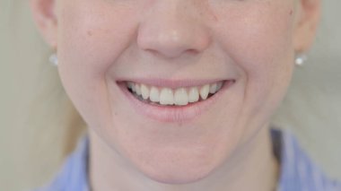 Gülümseyen Genç Kadın Dudakları ve Dişleri