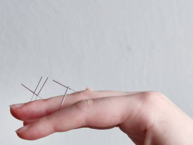 Su Jok terapisi, Su Jok kadın parmaklarına iğne batırıyor.