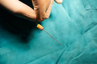 Epilepsi ameliyatında beyin dalgası kaydı için stereoelektroensefalografi elektrodu ya da stereoEEG tutan nörocerrah eli yakından görülüyor.