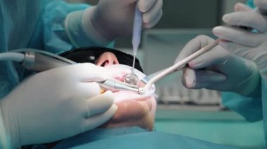 Asistanı olan doktor bir hastanın dişlerini tedavi ediyor. Ellerinde matkap ve tıbbi aletler olan eldivenler. Hastanın ağzı açık. Yakın plan. Diş Kliniği.
