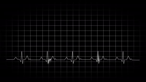 Monitorização Ekg Emergência Eletrocardiograma Linha Branca Batimento Cardíaco Fundo Preto — Vídeo de Stock