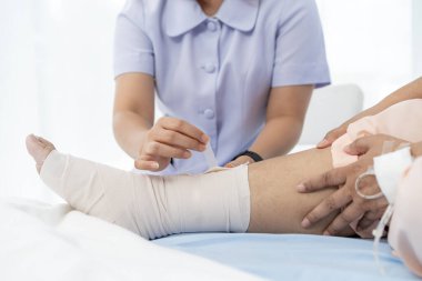 Hastaneye yatırılan yaşlı bir Asyalı hastanın yakın plan fotoğrafı. Bir hemşire yaralı bir hastanın bacağındaki bandajla ilgilenir. Hemşire, hastane ya da klinikte hastalara bakar..