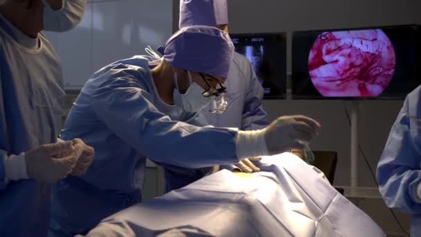 手持式枪法 专业的外科医生在手术室对床上麻醉的女病人进行手术切除 年轻的男性助手站在旁边 看护病人交出手术刀 — 图库视频影像