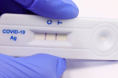 Kovid 19 virüsü ve mavi eldiveni aramak için alınan genizden alınan örnek pozitif çıktı.