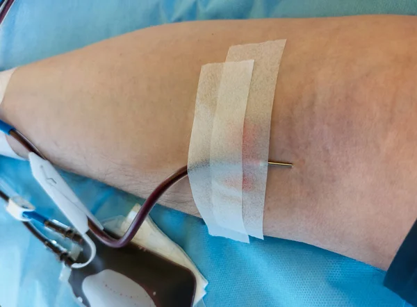 needle stuck in blood young person arm during blood transfusion at hospital