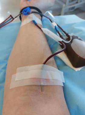 needle stuck in blood young person arm during blood transfusion at hospital
