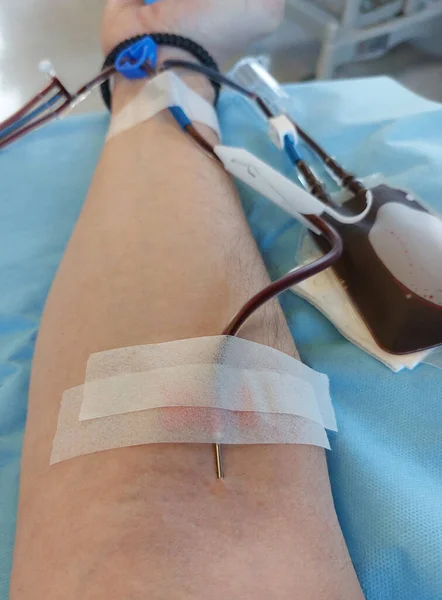 needle stuck in blood young person arm during blood transfusion at hospital