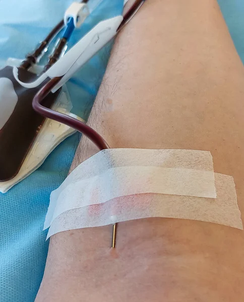 blood donor with big needle stuck in forearm during donation at hospital