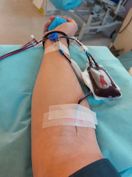 blood donor with big needle stuck in forearm during donation at hospital