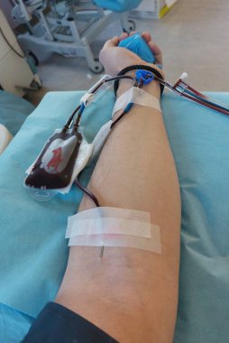blood donor arm with needle in the arm during donation