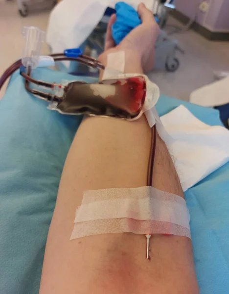 Caucasian man with needle stuck in arm at hospital during blood transfusion