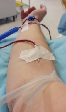 İğne batırılmış bir insan kolu ve hastane sedyesinde kanla dolu plastik bir tüp.