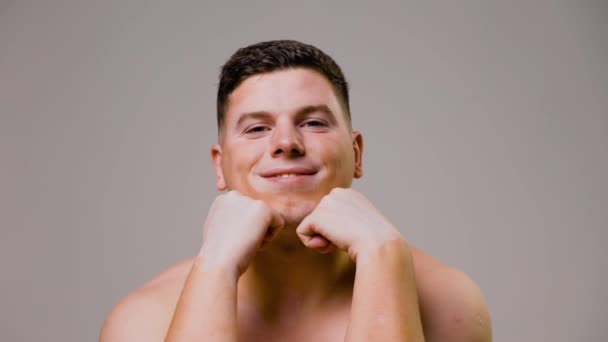 Młody Mężczyzna Pokazuje Stan Skóry Zaburzeniami Witiligo Uśmiechając Się Aparatu — Wideo stockowe