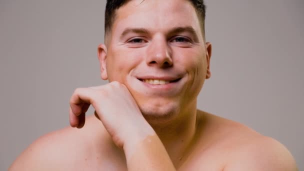Genetisk Sjukdom Vitiligo Studeras Inte Ung Man Hudpigmentering Visar Begreppet — Stockvideo