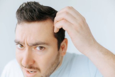 Bir adam endişeli bir ifadeyle saç çizgisini yakından inceliyor, kafa derisine iyi aydınlatılmış, basit bir şekilde dokunuyor. Arka plan sade ve dikkat dağıtıcı değil, ona odaklanmış..