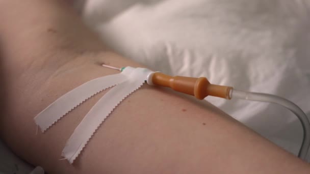 의료용 드로퍼 바늘의 바늘은 팔꿈치에 초점이 않는다 정맥을 약물을 주입하는 — 비디오