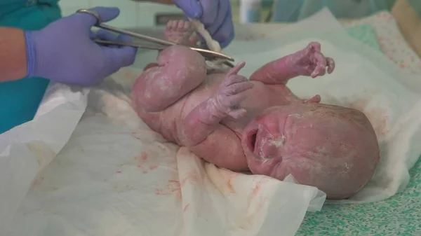 Eine Krankenschwester Durchtrennt Den Rest Der Nabelschnur Eines Neugeborenen Klemmen — Stockfoto