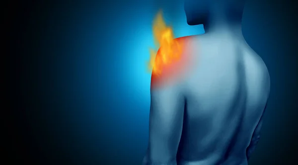 肩の痛みや痛みを伴う回転子のカフ関節の痛みや青の背景に3Dイラストスタイルで肩の損傷や作業事故に慢性的な燃焼痛みの炎症として腱損傷 — ストック写真